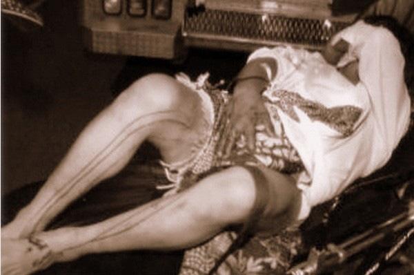 Chàng trai khóc thét vì cậu nhỏ biến mất sau đụng chạm và sự thật chứng bệnh nhiều người hãi-1