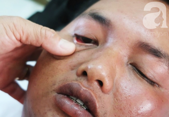 Dịch sởi đang diễn biến bất thường nhưng nhiều bà mẹ vẫn anti vaccine: Coi chừng mất mạng con-4