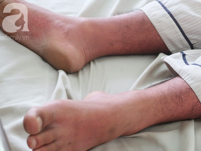 Dịch sởi đang diễn biến bất thường nhưng nhiều bà mẹ vẫn anti vaccine: Coi chừng mất mạng con-5