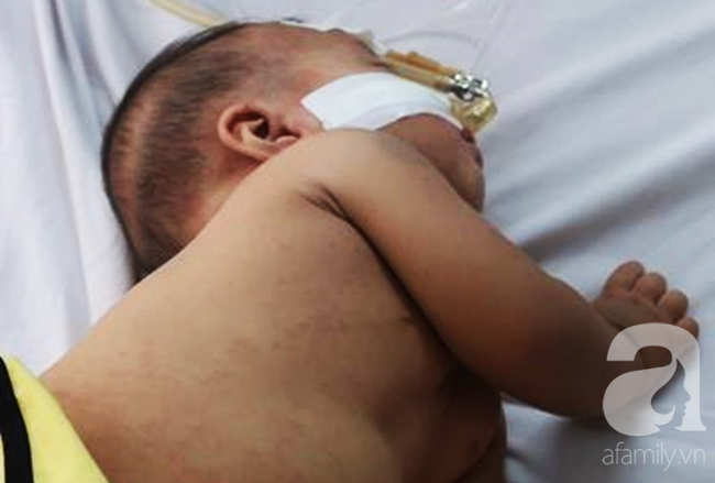 Dịch sởi đang diễn biến bất thường nhưng nhiều bà mẹ vẫn anti vaccine: Coi chừng mất mạng con-10