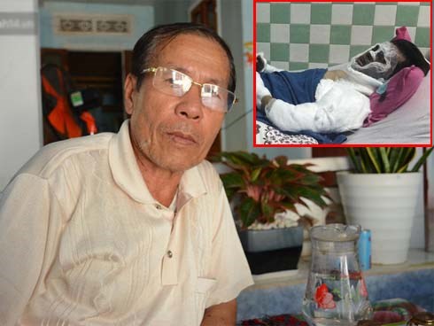 Người cha đau xót kể lại vụ việc con trai bị tạt axit, cắt gân chân khi chở bạn gái đi chơi Tết