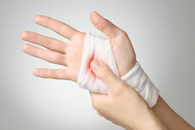 Nếu không may bị đứt tay thì đây chính xác là những gì bạn phải làm-2