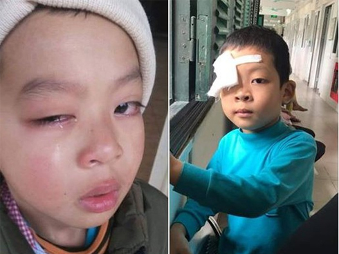 Con bị đánh, cha đề nghị trường bồi thường… 100 triệu đồng-2