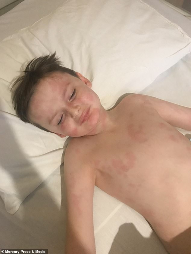 Bé trai 6 tuổi bị đau đầu, nôn mửa, rơi vào hôn mê vì thủ phạm là căn bệnh nguy hiểm mà cha mẹ nào cũng sợ-3