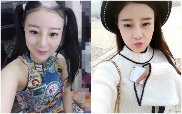 Mỹ nữ hói đầu vì ăn ngô bằng máy khoan khiến cư dân mạng bất ngờ trước diện mạo và cuộc sống hiện tại-3