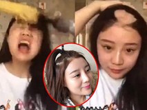 Mỹ nữ hói đầu vì ăn ngô bằng máy khoan khiến cư dân mạng bất ngờ trước diện mạo và cuộc sống hiện tại Mỹ nữ hói đầu vì ăn ngô bằng máy khoan khiến cư dân mạng bất ngờ trước diện mạo và cuộc sống hiện tại