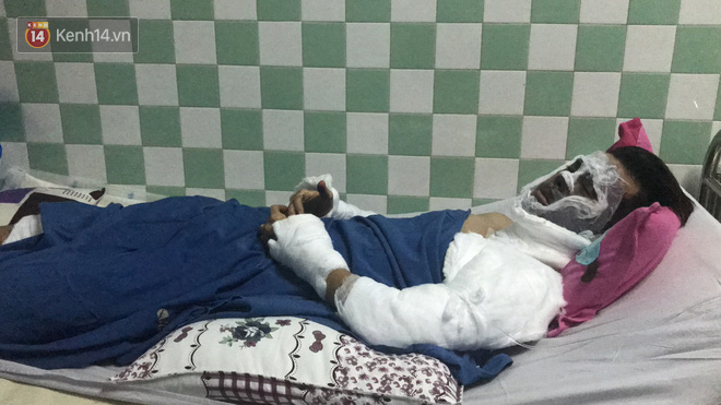 Việt kiều bị tạt axit khi đi chơi Tết với bạn gái vẫn còn mê man, mắt tổn thương nặng, thị lực chỉ còn 15 - 20%-1