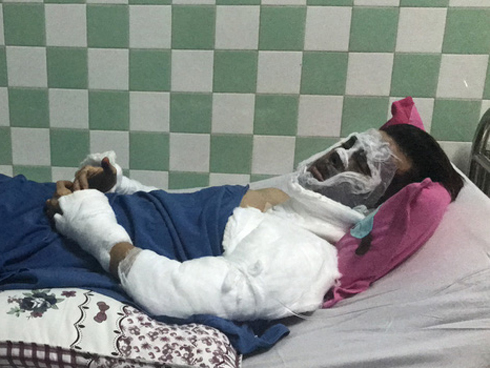 Nam Việt kiều Canada bị tạt axit hỏi anh trai tại hiện trường: Sao anh làm vậy với em?-3