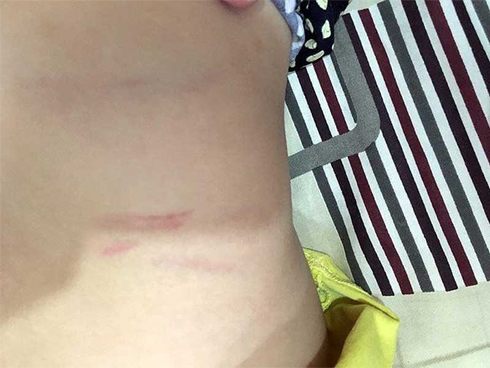 Con bị đánh, cha đề nghị trường bồi thường… 100 triệu đồng-1