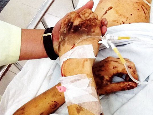 Thiếu nữ xinh đẹp nhận đi... khách để lấy tiền phẫu thuật cho mẹ: Bệnh viện nói gì?-3