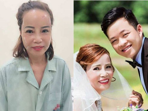 Cô dâu Cao Bằng 62 tuổi lấy chú rể 26 tuổi sức khỏe yếu hậu thẩm mỹ