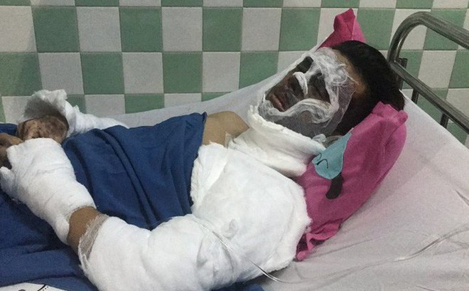 Vụ Việt kiều bị tạt axit, cắt gân chân: Người cha bất ngờ thông tin về 2 cuộc gọi của con trai cả-1
