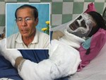 Vụ Việt kiều Canada bị tạt axit, cắt gân chân: Nạn nhân sống trong sợ hãi, hung thủ vẫn bí ẩn-2