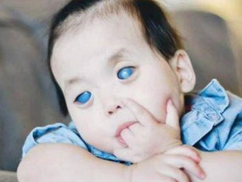 Bé gái có đôi mắt xanh thẳm khiến em khóc trong đau đớn 16 tiếng/ngày sau 1 năm nhận nuôi đã có sự thay đổi ngoạn mục-9