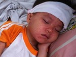 Không tiêm vắc-xin uốn ván, cậu bé 6 tuổi mất 19 tỷ tiền chữa bệnh-3