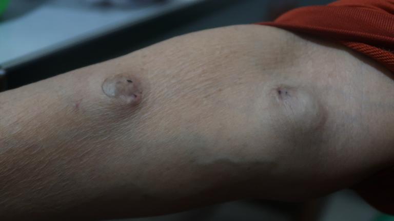 Xót xa cảnh người mẹ co ro ôm hũ hài cốt của con trai vào phòng bệnh để chạy thận-5