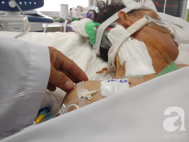 Người chồng tuyệt vọng tìm 180 triệu cứu vợ bị ong đốt nguy kịch: Vợ tỉnh đi, con trai chúng ta đang chờ”-6