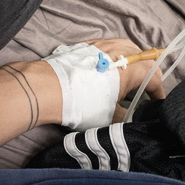 Ca sĩ Đại Nhân nhập viện vì tai biến ở tuổi 32 và lời cảnh báo của nam ca sĩ khi có những triệu chứng đáng sợ-1