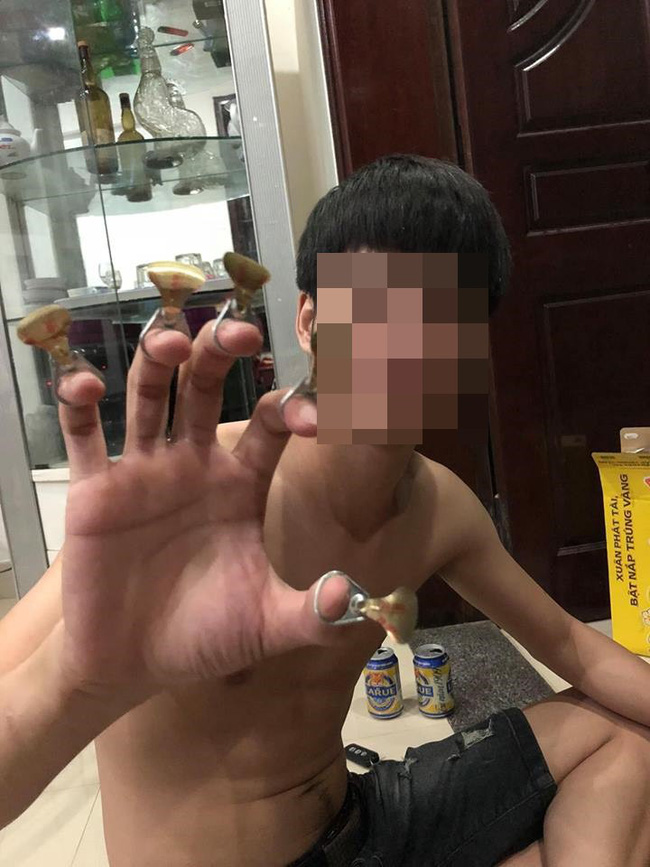 Ca lụy tình khiến MXH sôi máu: Cô gái vẫn tha thứ mặc bạn trai nhiều lần bạo hành dù vào viện như cơm bữa-1