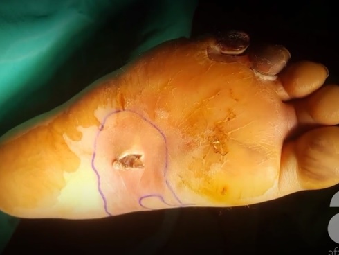 Những loại quả là thần dược cho người bị tiểu đường-7