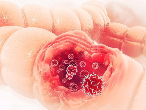 Nghiện ăn gà rán, uống trà sữa, người phụ nữ vác bụng bầu đi khám và nhận kết đắng-4