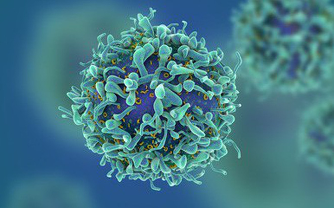 Việt Nam xuất hiện ca bệnh hiếm - 1 bệnh nhân mắc cùng lúc 3 bệnh ung thư-1