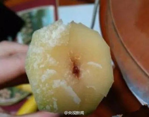 Người phụ nữ suy đa tạng sau ăn mía, cảnh báo nên vứt bỏ nếu có dấu hiệu này-2