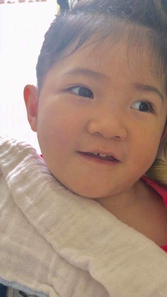 Hình ảnh mới nhất của bé gái Lào Cai bị suy dinh dưỡng: Cằm nhọn, cao lớn không nhận ra-9