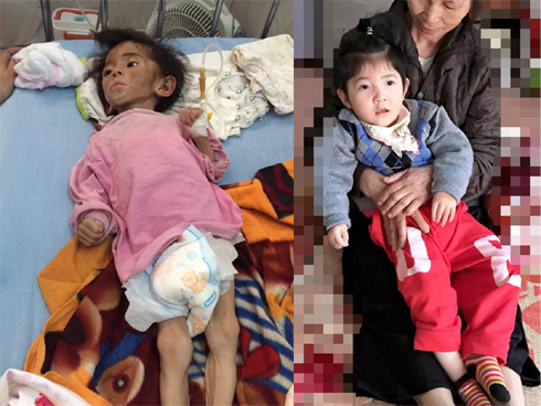 Bị hàng xóm đuổi chém trong đêm, chồng cố gắng đỡ dao cho vợ bầu và con nhỏ dẫn đến bị thương-2