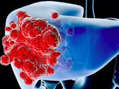 Những dấu hiệu cực bình thường báo hiệu nhiều bệnh chết người-5