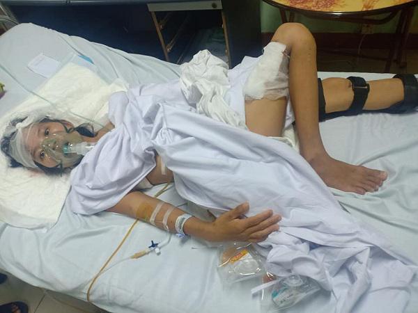 Bị nạn khi đi mua sữa, cô giáo trẻ giành giật sự sống từng ngày mong về gặp con-2