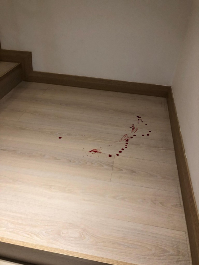 Con trai bị ngã từ cầu thang xuống mà không khóc, bà mẹ vô tư không cho con đi kiểm tra để rồi nhận kết quả gây sốc-2