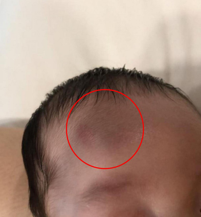 Con trai bị ngã từ cầu thang xuống mà không khóc, bà mẹ vô tư không cho con đi kiểm tra để rồi nhận kết quả gây sốc-3