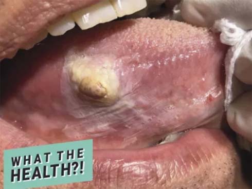 Đàn ông to cao rất dễ bị căn bệnh ung thư này tấn công: Bạn đừng để biết khi đã quá muộn-4