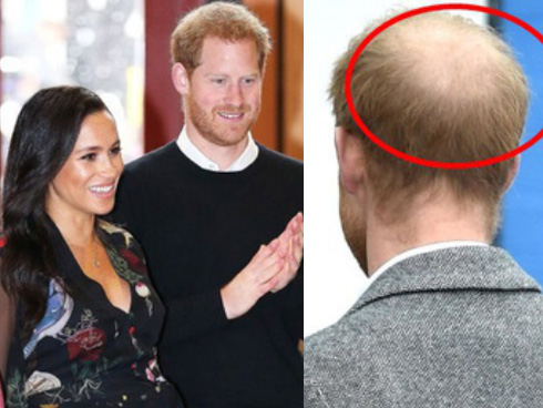 Công nương Meghan khoét sâu thêm mâu thuẫn với chị dâu khi quyết làm điều khác người với đứa con còn chưa lọt lòng?-4