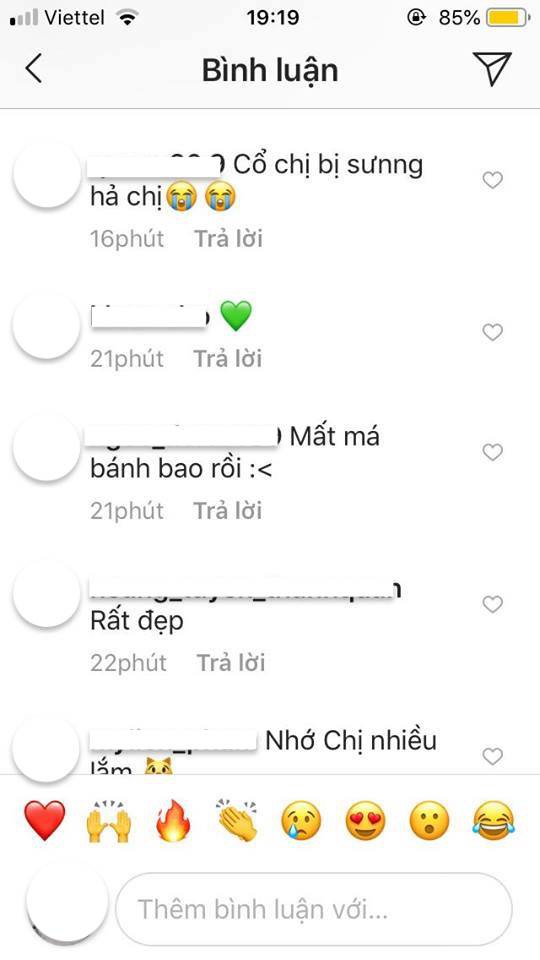 Bị fan nhận xét khuôn mặt khác lạ và cổ sưng to bất thường trong hình ảnh mới, Phạm Hương lập tức có hành động này-2