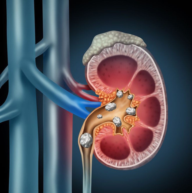 Không chỉ bảo vệ sức khỏe tim, trí não và hệ miễn dịch, các loại trái cây có múi còn có những tác dụng này-3