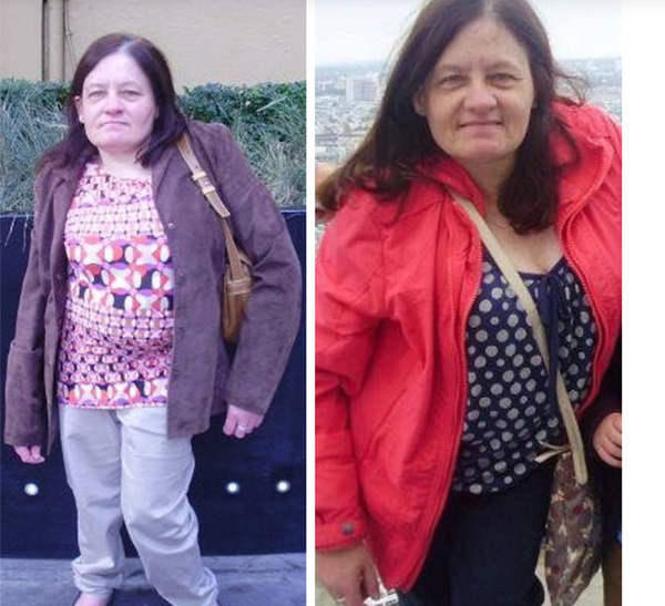 Chưa hỏi kỹ đã vội vàng mổ lấy con cho người phụ nữ mang thai 8 tháng bị tai nạn xe, bác sĩ choáng váng khi nhìn vào bên trong tử cung-3