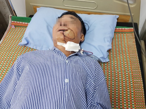 12 cách chữa căn bệnh nhiệt miệng đáng ghét-5