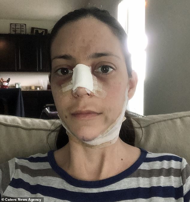 Chi gần 1 tỷ phẫu thuật giống công nương Meghan, hai người phụ nữ nhận được kết quả bất ngờ-4