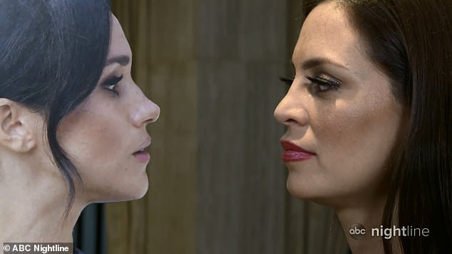 Chi gần 1 tỷ phẫu thuật giống công nương Meghan, hai người phụ nữ nhận được kết quả bất ngờ-5