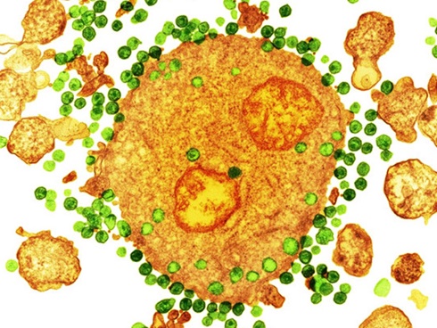 Bác sĩ Việt Nam có thể chữa khỏi HIV?-2