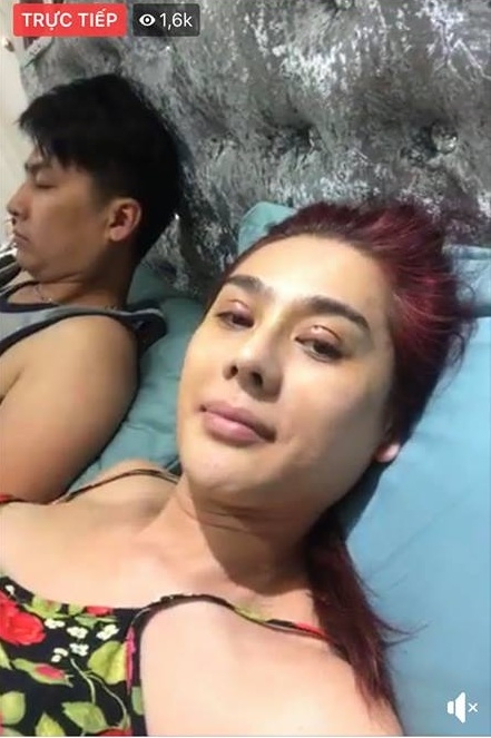 Hết gây sửng sốt với ảnh livestream cắt mí sưng vù, Lâm Khánh Chi lại tiếp tục bơm môi trùng tu nhan sắc-4