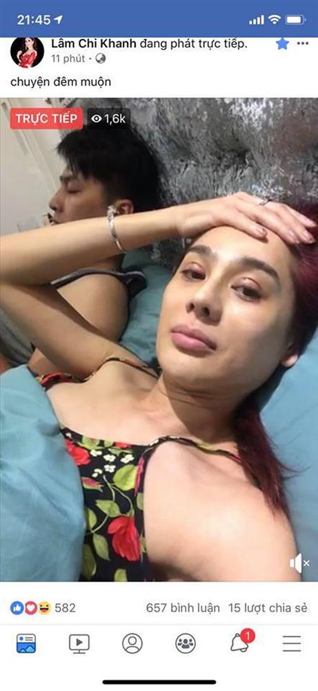 Hết gây sửng sốt với ảnh livestream cắt mí sưng vù, Lâm Khánh Chi lại tiếp tục bơm môi trùng tu nhan sắc-6