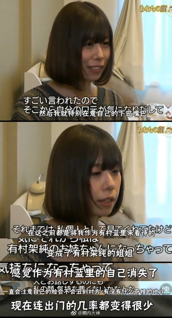 Bị chê bai không xinh bằng em gái suốt 3 năm, mỹ nhân Nhật Bản ghi lại toàn bộ quá trình thẩm mỹ trong nước mắt-3