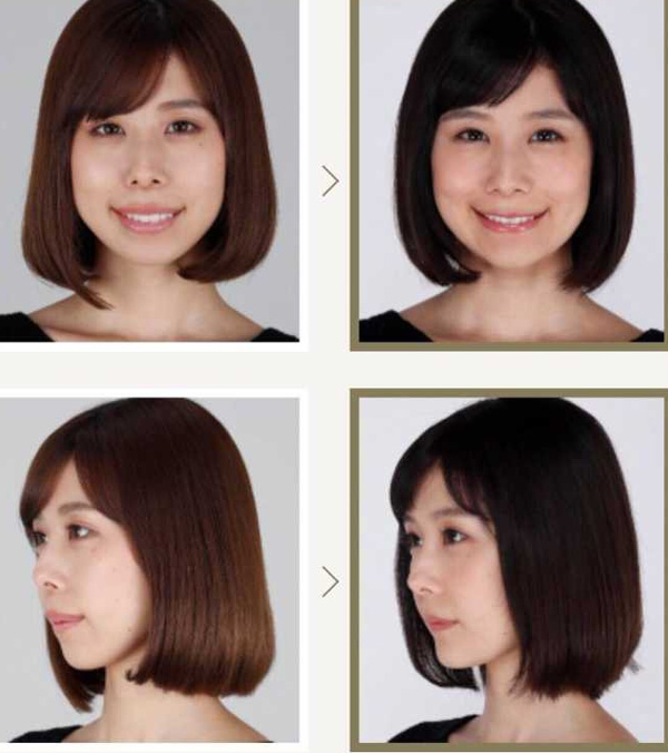 Bị chê bai không xinh bằng em gái suốt 3 năm, mỹ nhân Nhật Bản ghi lại toàn bộ quá trình thẩm mỹ trong nước mắt-6