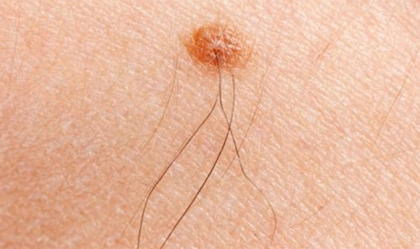 LÔNG mọc ở vị trí này trên cơ thể bạn sẽ PHÁT TÀI TIỀN TIÊU KHÔNG HẾT, VÀNG BẠC ĐẦY TAY-2