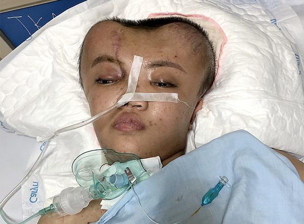 Cô gái 19 tuổi đầu biến dạng chia làm hai nửa và ánh mắt nhòe lệ cầu xin sự sống-1