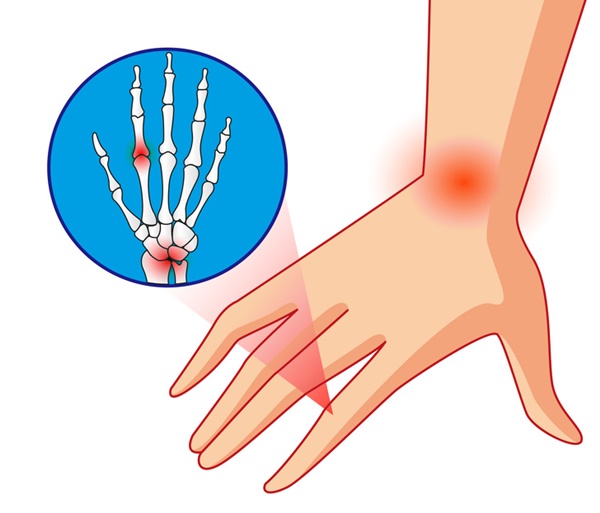 Những dấu hiệu giúp bạn tự phát hiện sớm 10 bệnh nguy hiểm phổ biến nhất hiện nay-3