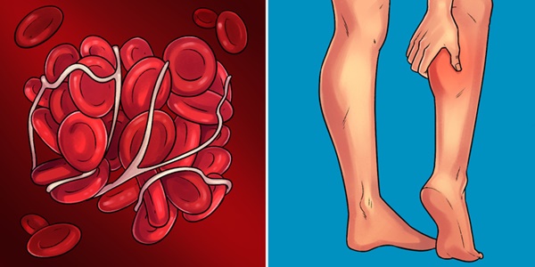 Những dấu hiệu giúp bạn tự phát hiện sớm 10 bệnh nguy hiểm phổ biến nhất hiện nay-9